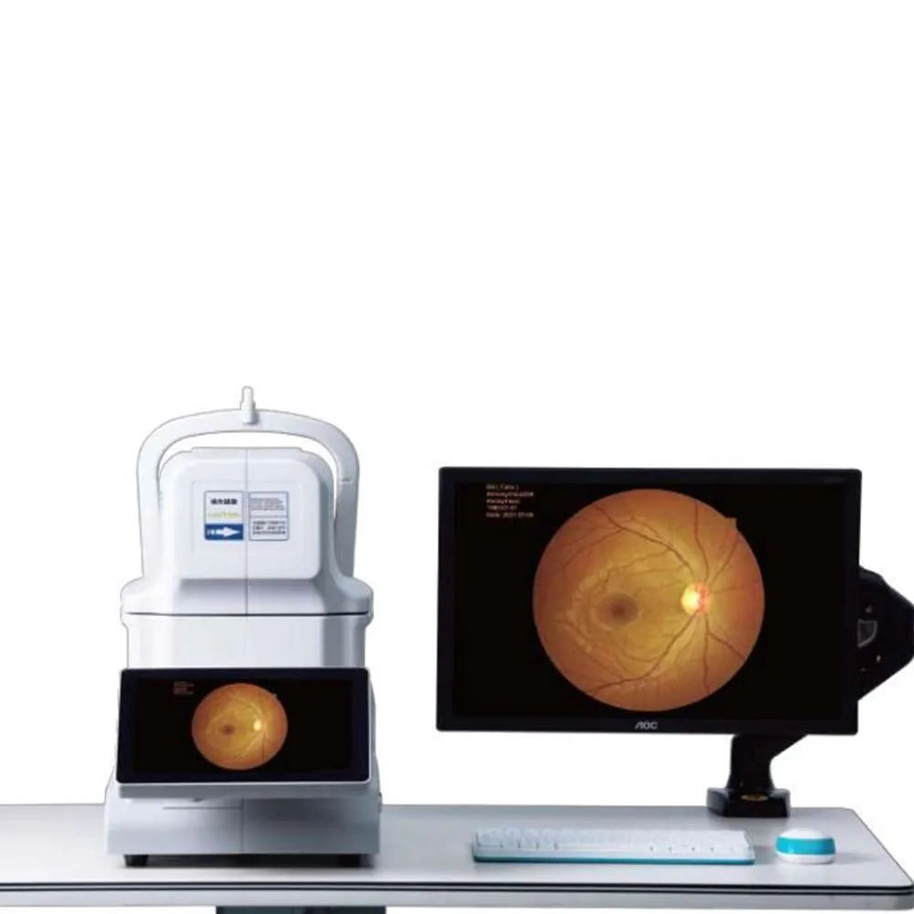 Intelligent surgical ophthalmic equipment non-mydriasis automatic fundus camera