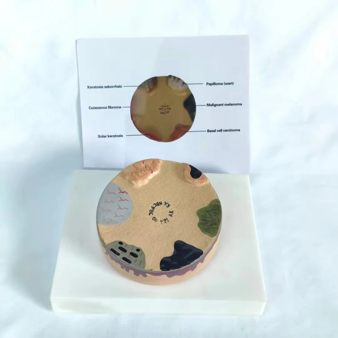 Medical Sciences, Anatomical Models of Human Skin Diseases, School of Medicine Simulation Learning Resources