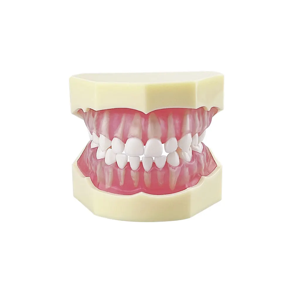 Kids Teeth Model For Training Practice Tooth Extraction Model Dental Standard Model With Removable Teeth Gums Children TYPODONT