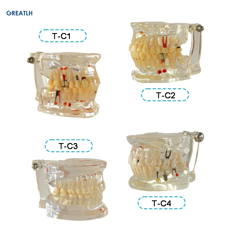 

Dental model Teeth model gum teeth Teaching Model Standard Dental Typodont Model Demonstration