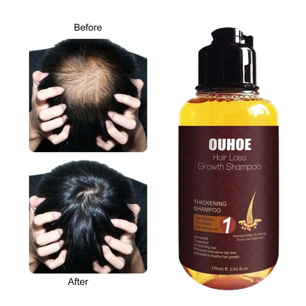 Hair Strengthening Shampoo  Effective Mild Formula Gentle  Prevents Hair Loss Hair Growth Shampoo for Unisex