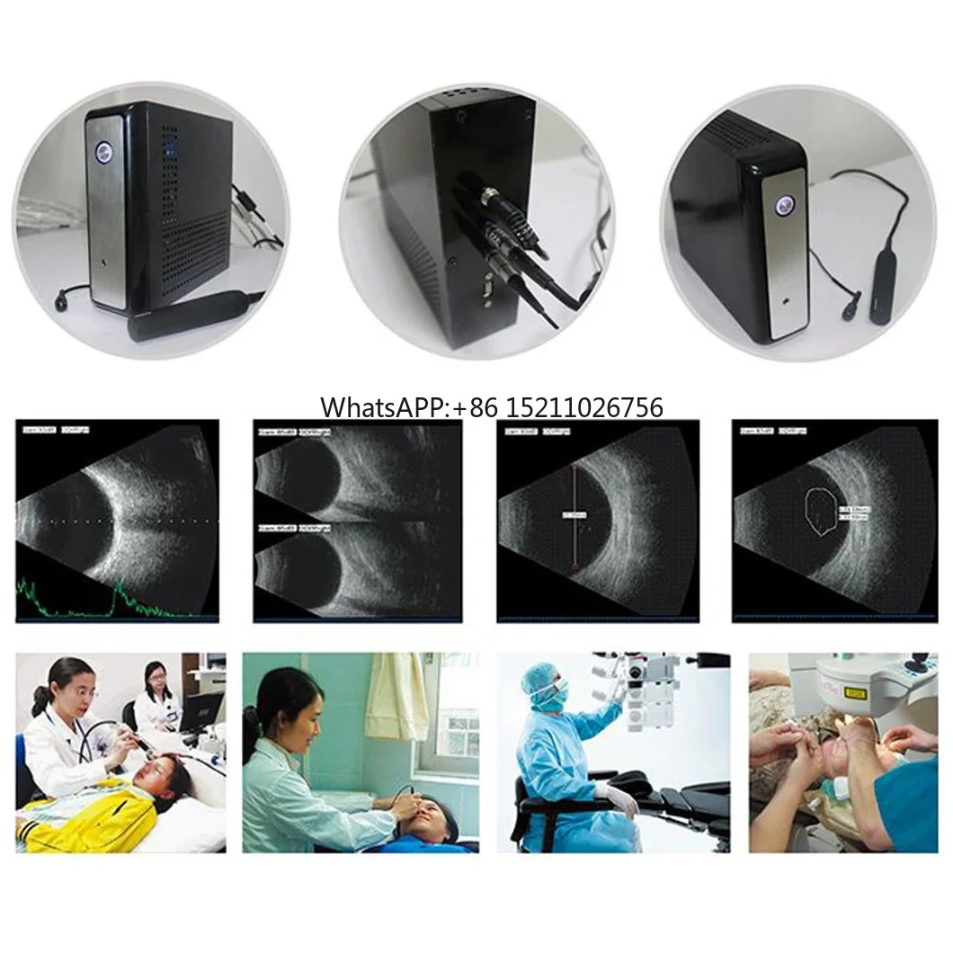 HO-200 Hospital Medical Diagnosis Ophthalmic A/B Ultrasound Box Ophthalmic Scanner