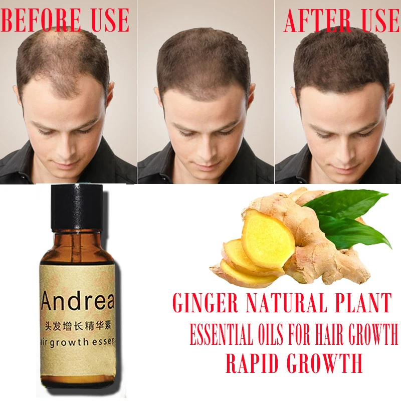 2/5/10Pcs Andrea Hair Growth Serum Oil Herbal Keratin Fast Hair Growth Alopecia Loss Liquid Ginger Sunburst Yuda Pilatory Oil