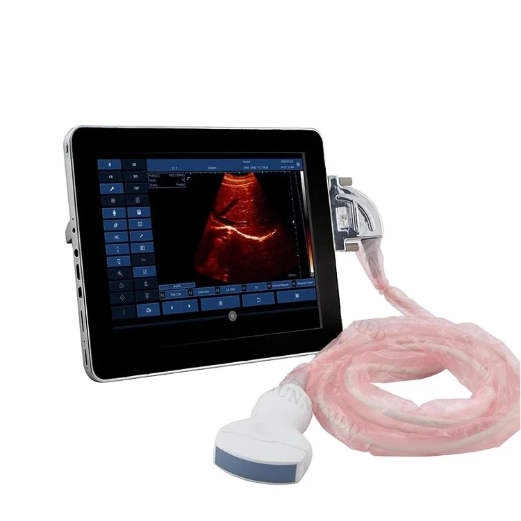 Portable ultrasound wireless hand ultrasound convex probe Clinic use Digital PC Platform Dual interface Ultrasound Sca