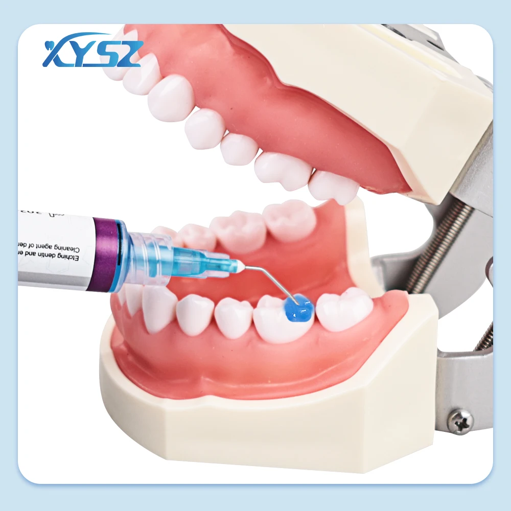 Universal Dental Cura Light Glue, resina composta, colagem adesiva, Etch Gel Kit, suporte ortodôntico, gel de dentes