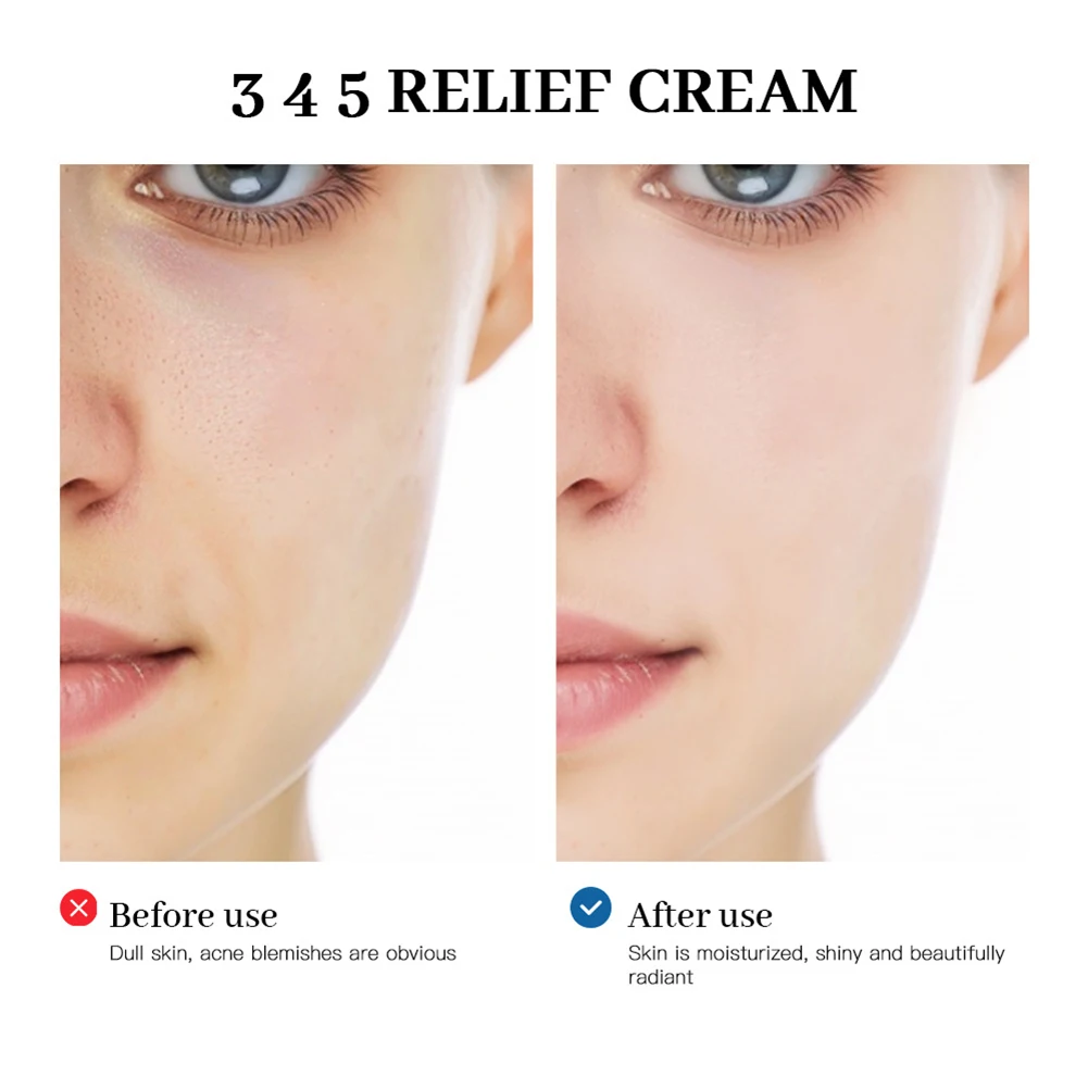 345 Intensives Repair Cream Acnes Relief Face Natuurlijke zachte vochtinbrengende crème Hydraterende voedende huidverzorging voor alle huidtypes