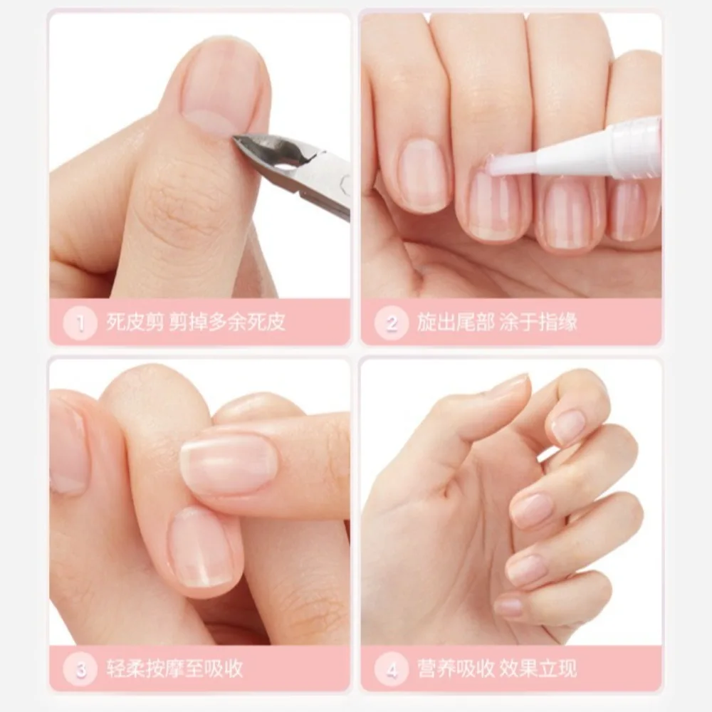 ดอกไม้บํารุงปากกาเล็บน้ํามันบํารุงเล็บซ่อมและปรับปรุงเปราะบางเล็บพื้นผิวป้องกันการแตกหัก Cuticle Oil Uñas