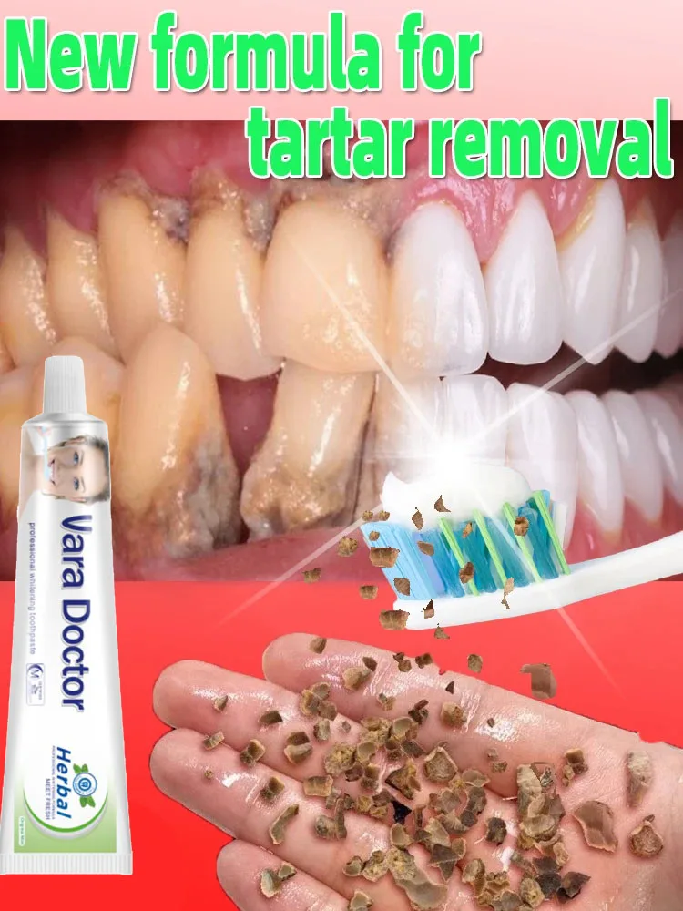 100g Whitening Toothpaste Remover Dental Calculus Whitening Teeth Mouth Odor Removal Bad Breath Preventing Periodontitis 2024