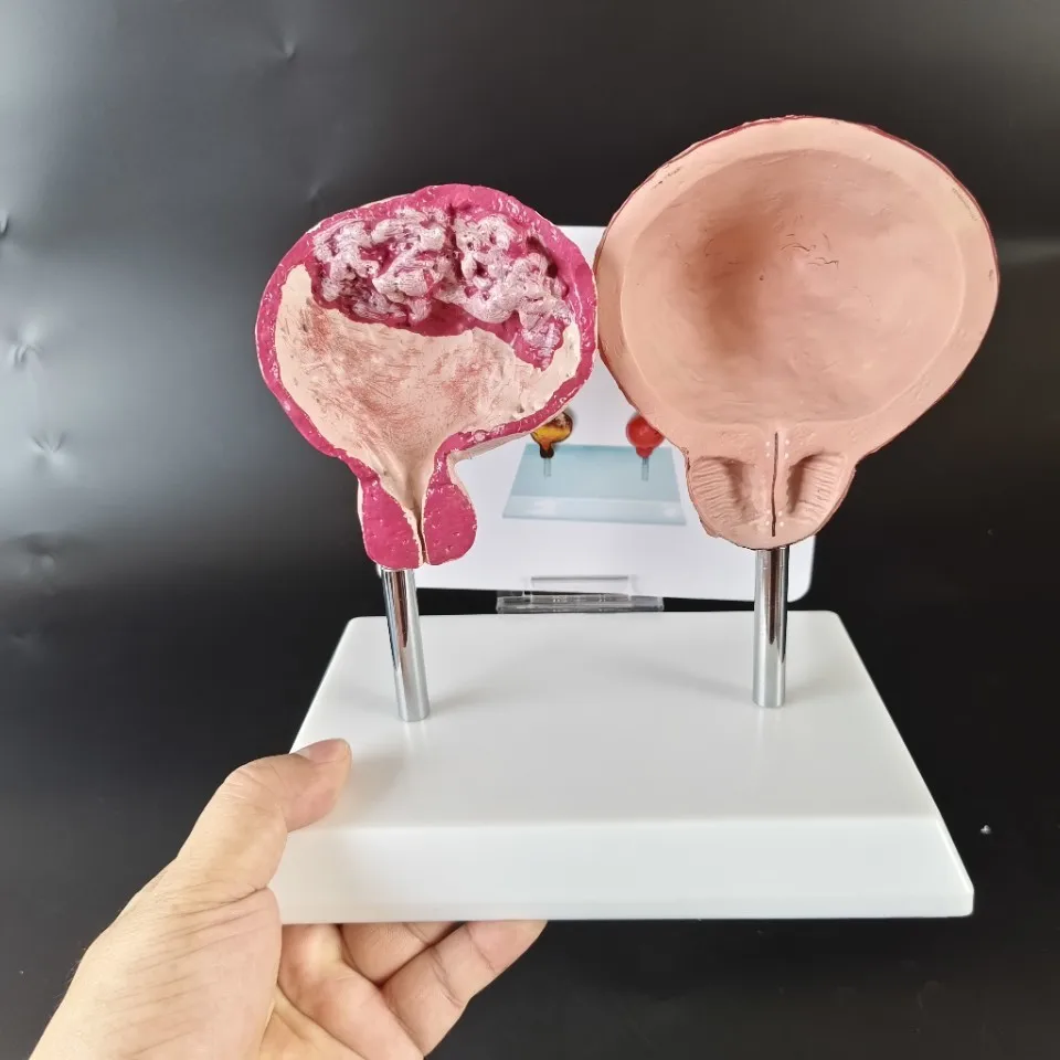 Comparison of normal visceral organs with heart and lung bladder vessels, oral tracheal fetal medical model