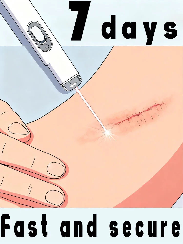

Remove all scars in 7 days