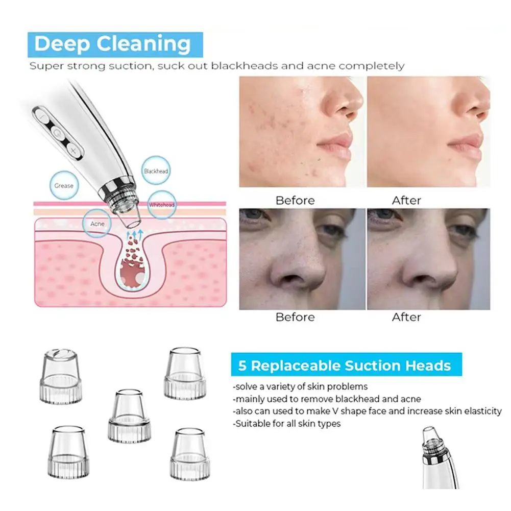 Akumulatorowy odkurzacz do porów twarzy USB, odkurzacz do usuwania zaskórników, przenośne narzędzie do usuwania trądziku, urządzenie do oczyszczania twarzy