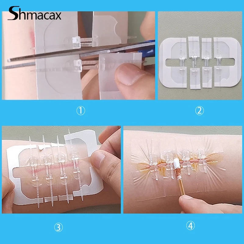 1/3/10Pcs Zipper Tie Wound Closure Patch Hemostatic Patch Wound Fast Suture Zipper Band-Aid Outdoor Portable Skin Care