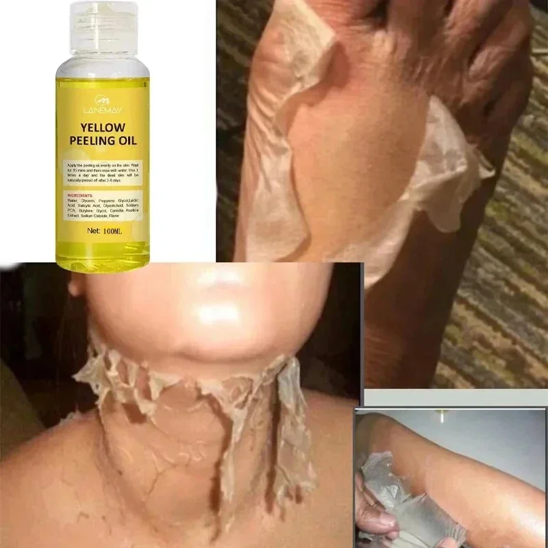 Body Care Exfoliating Yellow Peeling Oil 100% Organic Bleaching Dark Skin Serum Dark Knuckles Fast Whitening Cosmetics