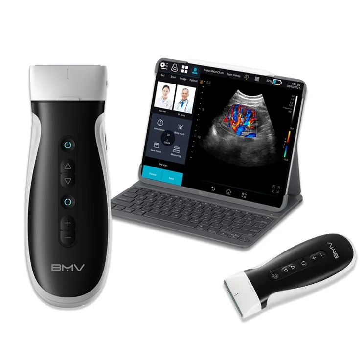 Veterinary128/192 Elements Handheld USB WiFi Color  Scanner Portable Wireless  Medical  machine