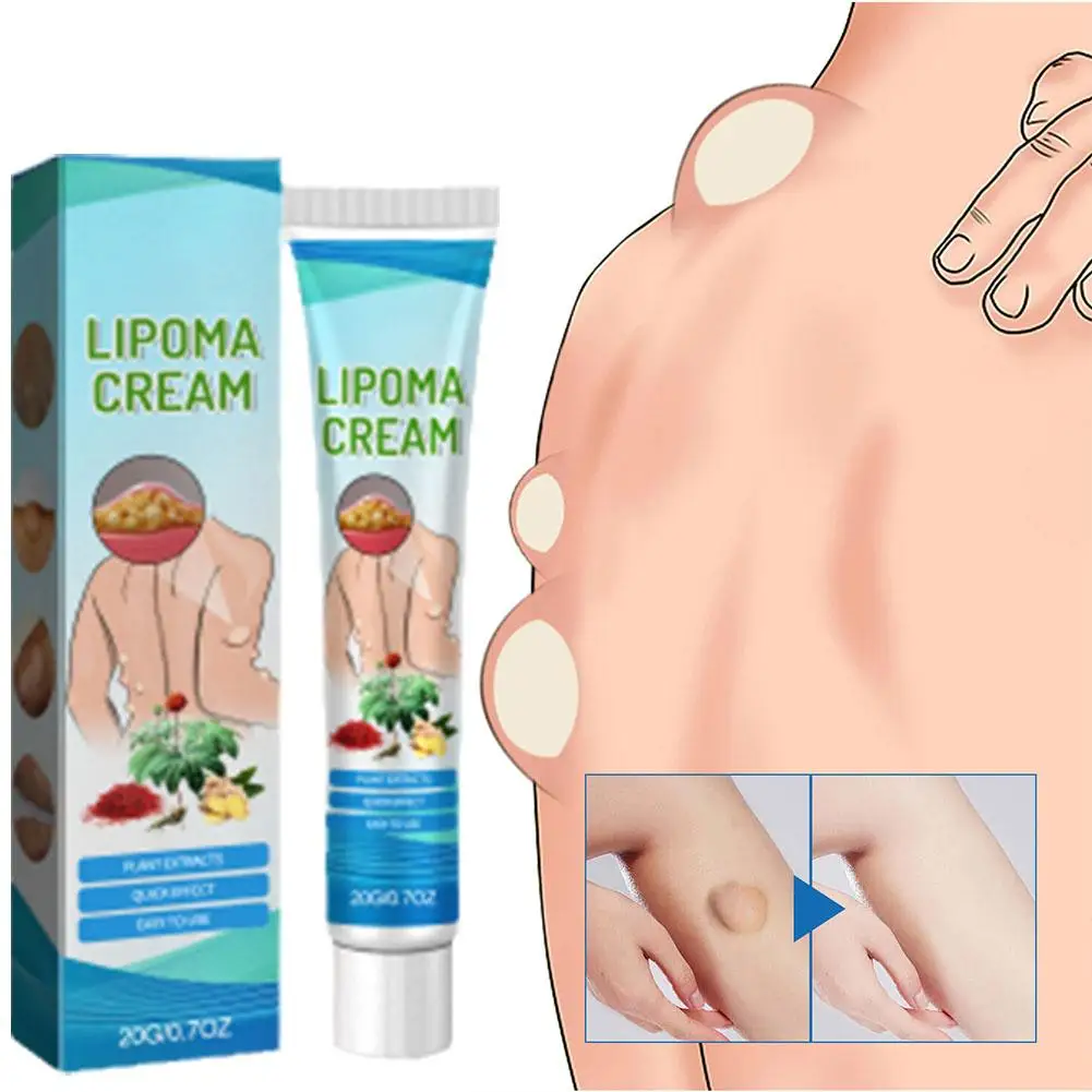 Natural Plant Lipoma Removal Cream Extract Treatments Plaster Removes Lipomas Fibroids Subcutaneous Lumps Pain Relief Skin Care