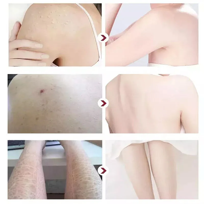 エクスフォーティングボディスクラバー、バスsalwater、肌の若返り、500ml