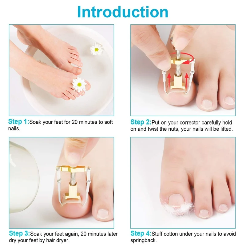 Ingrown Toe Pedicure e Pé Nail Care Corrector, Manicure Ferramentas para Pés, Orthotic Acronyx, Onyxis Bunion Corrector