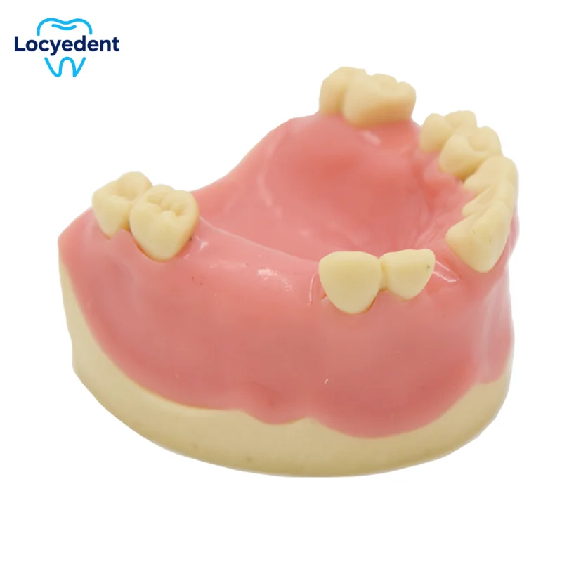 1Pcs Dental Implant Model Training Teeth Model For Dental Technician Practice Studying Dentistry Teaching Display Tooth Models