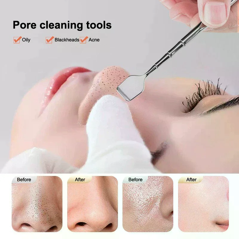 Ferramenta de remoção de cravo facial raspador facial para limpeza profunda espátula facial nariz removedor de cravo cuidados com a pele ferramentas de beleza