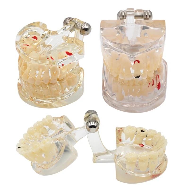 Dental Teeth Model Child Lactic Constant Alternating Model Kid Milk Permanent Study Demonstration Standard Dentist Student Model