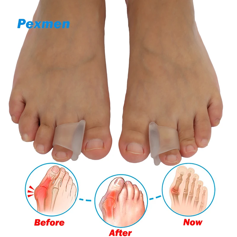 Pexmen 2Pcs Hammer Toe Corrector Hammertoe Straightener for Curled Crooked Bent Claw Toes Overlapping and Rubbing Toe Protector