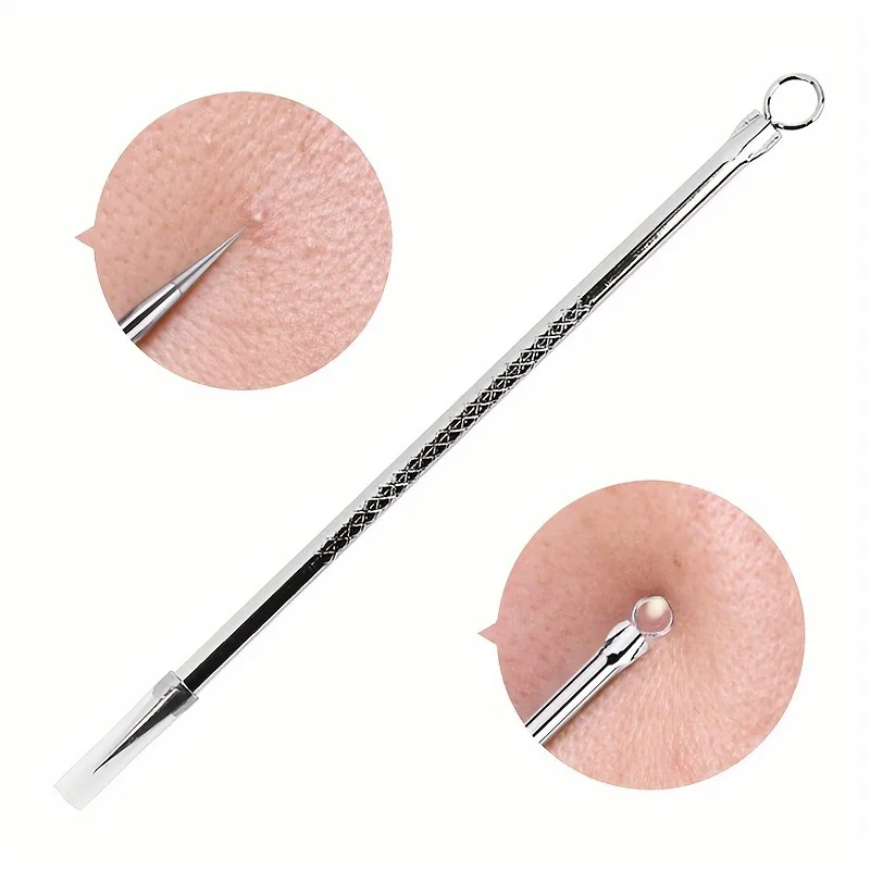 Stainless Steel Blackhead Remover: Pimple Popper Tool for Blemish, Whitehead, and Acne Removal - Suitable for Normal Skin