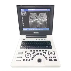 12 Inch LED Screen Black White Notebook Portable Sonography Human Use Ultrasound Scanner USG Machine