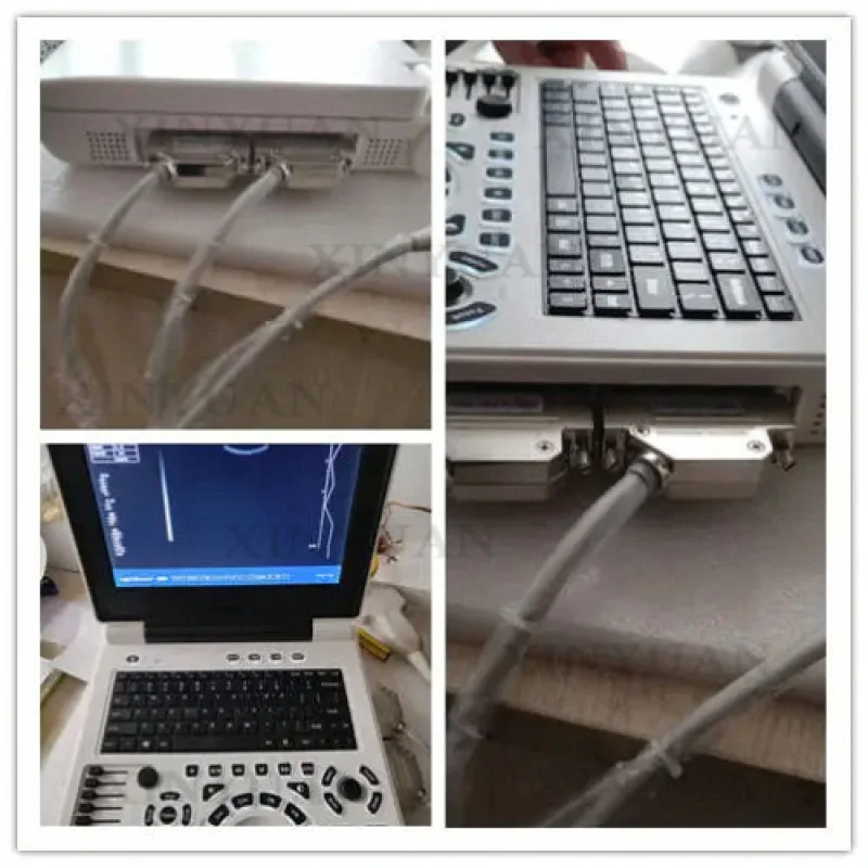 B Ultrasound, Economical Low-Cost Anti-Interference Precise Detector for Livestock Examination at Rural Veterinary Stations
