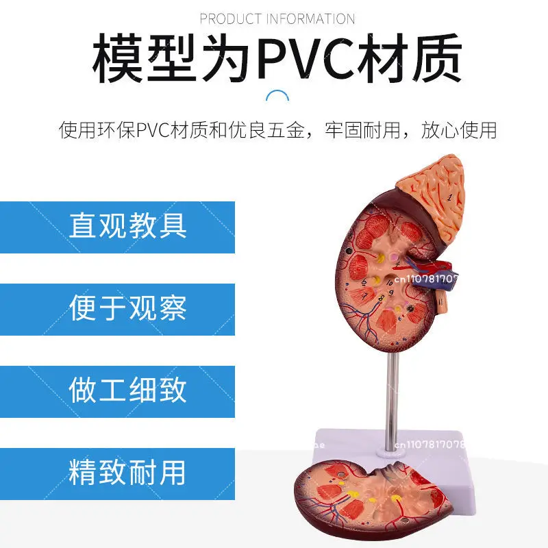 

Human Kidney Anatomy Model Diseased Kidney Model Nephron Glomerulus Anatomical Model Of Human Internal Organs