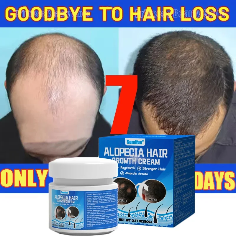 

Крем для быстрого роста волос против выпадения волос, предотвращение облысения, лечение кожи головы, восстановление корней, красота, здоровье, уход за волосами для мужчин и женщин