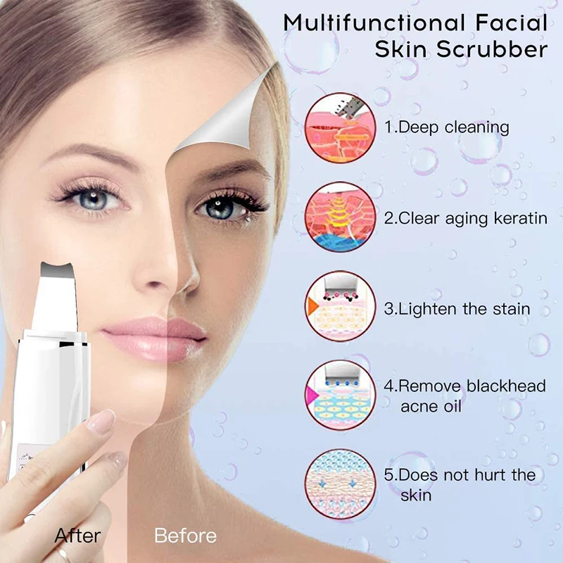 Hot Sale Face Massage Machine Skin Scrubber Facial Spatula Electric Dermabrasion Ultrasonic Ion Skin Scrubber