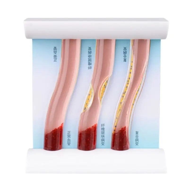 Contrast of vascular consistency blockage, showing a dynamic vascular model simulated by a die