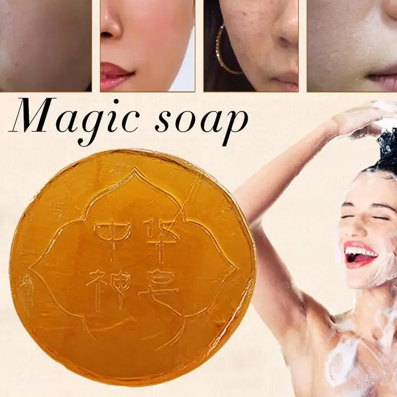 Magic Oil Control Soap Body Skin Exfoliating Whitening Natural Bath Oil Soap Shower Remover Cleansing Magic Soap 58g