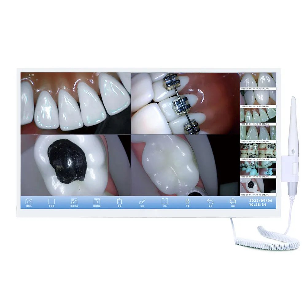 New Arrival Dental Endoscope WIFI Smart Zoom 21.5 Inch Touch Screen  Intra Oral / Medical Endoscope System