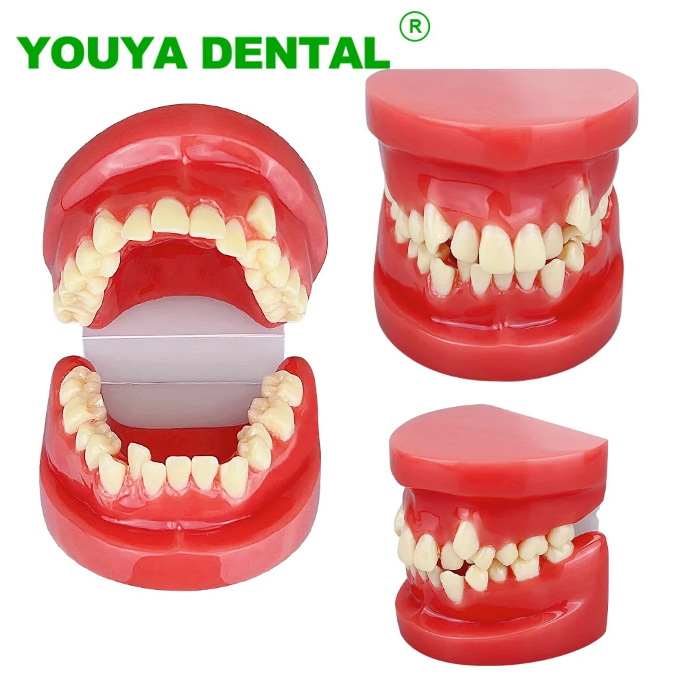 

Dental Teaching Model Teeth Malocclusion Model For Dentist Student Education Training Demonstration Tool Dentistry Lab Products