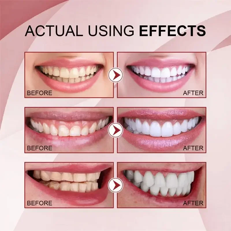 SP-6 Probiotic Whitening Toothpaste Clean Teeth Remove Stains Oral Care Fresh Breath With Sodium Saccharin Lactobacillus