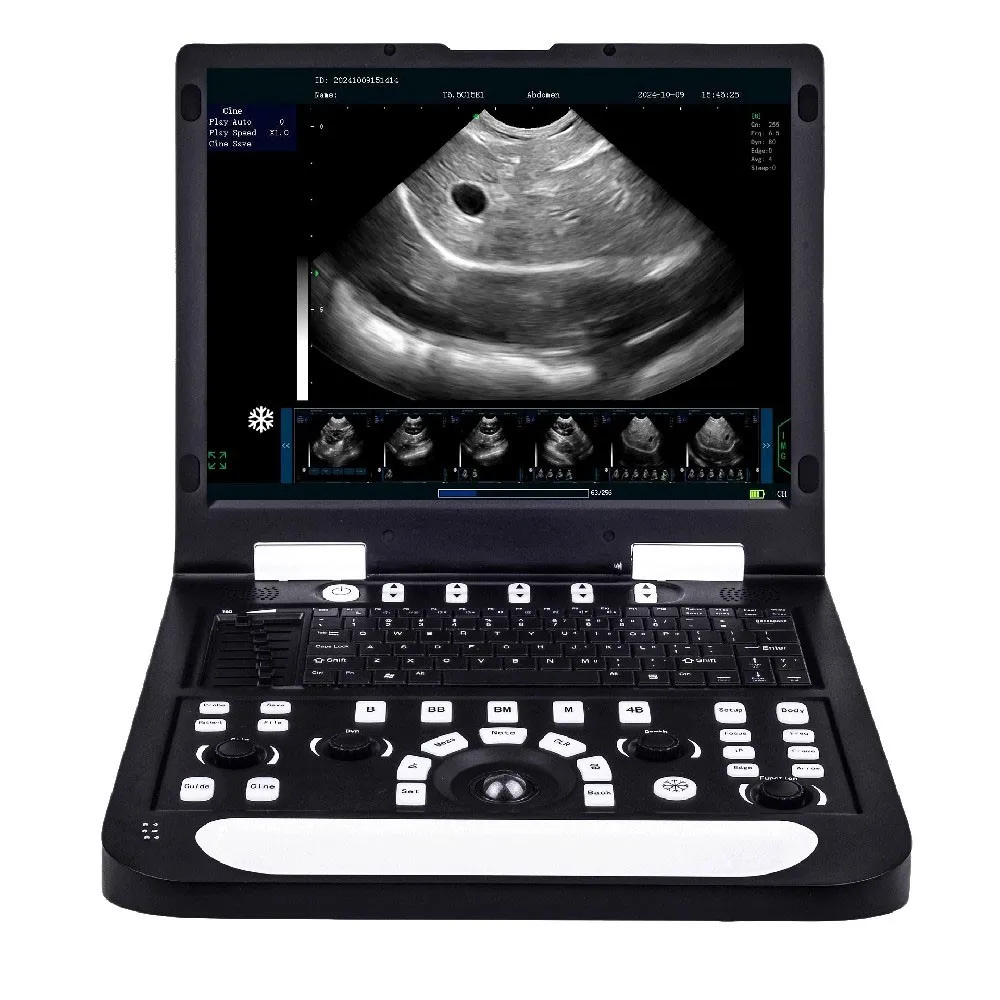 Maxgeek RS-N60 Full Digital PC Processing System Veterinary Ultrasonic Diagnostic Instrument 128G SSD 15-inch LCD