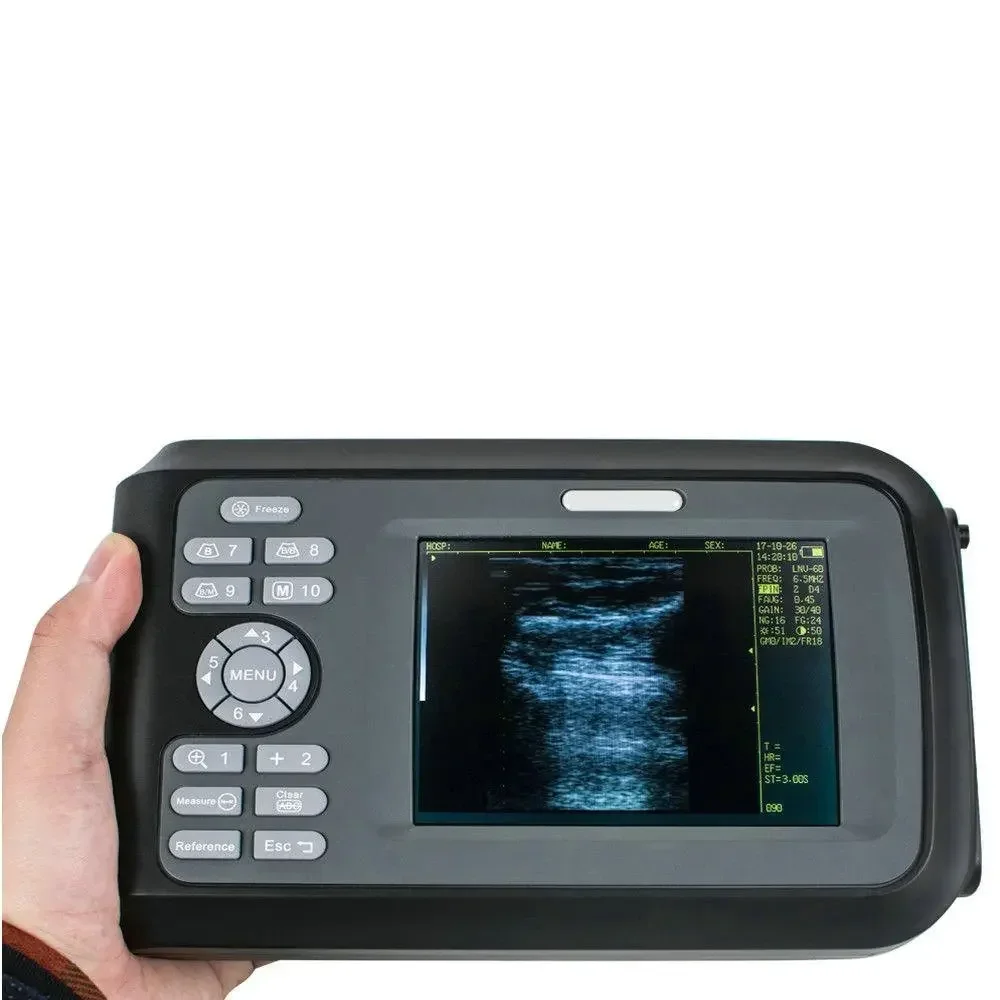 

Veterinary Ultrasound Machine/Equipment/Handscan V8