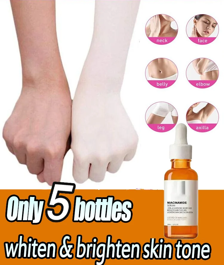 Skin Whitening Cream Private Parts Underarm Bleaching Serum Whiten Butt Knee Brighten Inner Thigh Arm Body Remove Dark Melanin