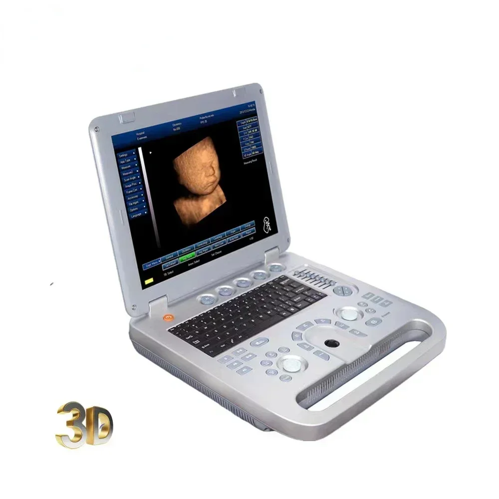 Échographie médicale numérique SUN-800D Sunbright ordinateur portable portable 3D machine à ultrasons usg