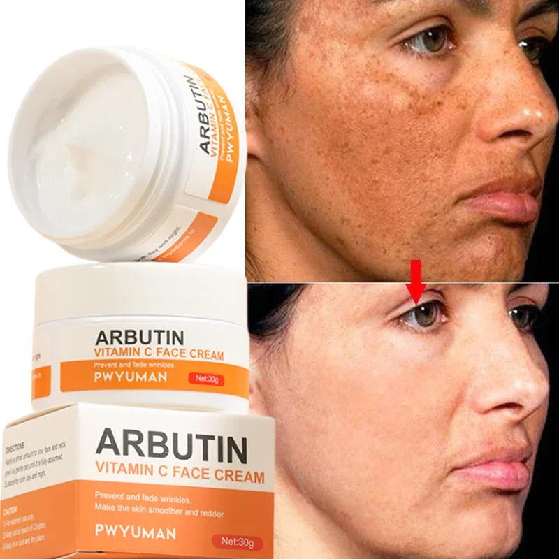 

Vitamin C Whitening Freckles Cream Effective Remove Dark Spots Fade Melasma Melanin Moisturizing Brighten Repair Dull Skin Care