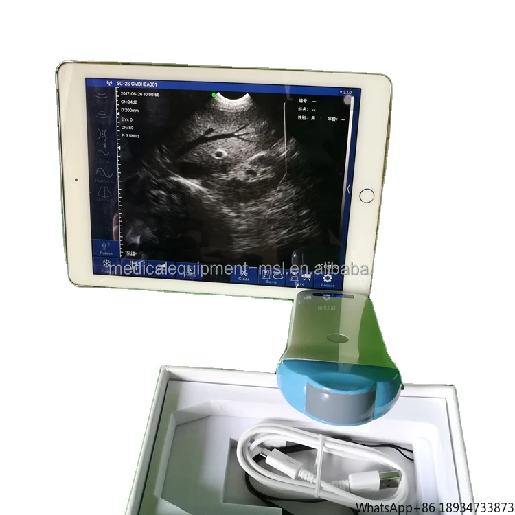 Newest Handheld ultrasound, wireless Micro-convex probe for baby or little children