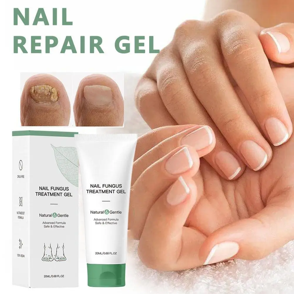 20ML Nail Repair Gel Foot Care Removal Repair Gel Natural Plant Formulas Foot Nail Fungus Essential Onychomycosis Nail Care