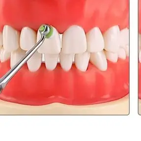 

60 шт., инструмент для наполнения стоматологической смолы, шпон, пенопластовые подушечки для реставрации композитной смолы, набор материалов для стоматологических инструментов