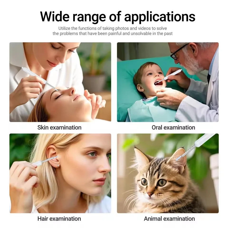 Digital Otoscope with 4.3 inch Screen 1080p HD Smart Visual Ear Camera Ear Wax Removal Tool Camera Support Photo Video Recording