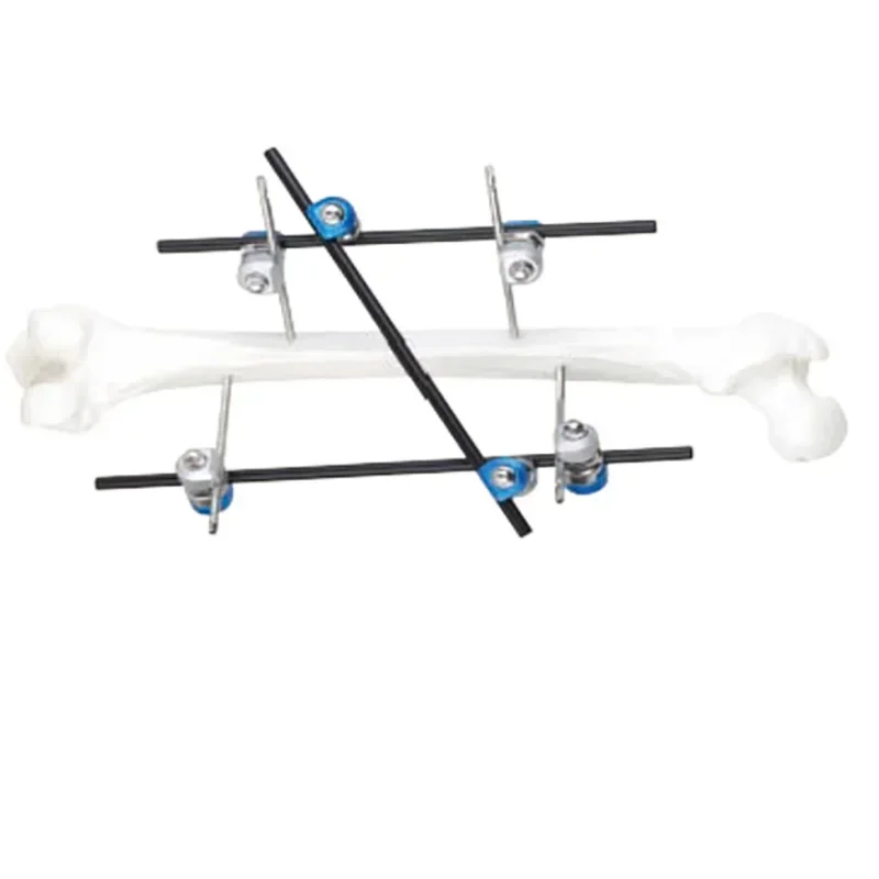 Fijador de medio anillo para implante ortopédico