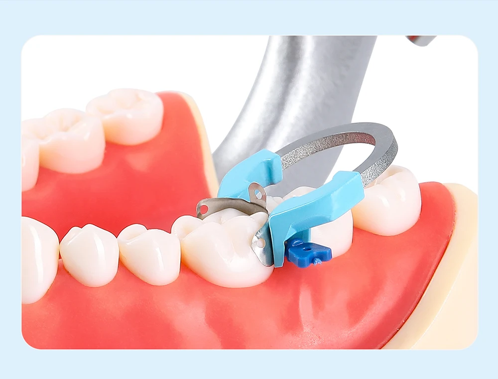 3-teiliges AZDENT Dental-Sektionsmatrizesystem, Matrizen, Clip-Ring, konturierte Matrizenbänder, Titan-Klemmring, universell schmal, tief – Detail 7