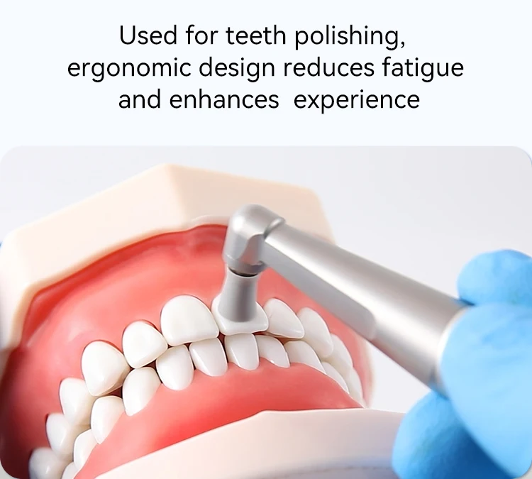 AZDENT Dental 4:1 Prophy Winkelstück mit niedriger Geschwindigkeit und Schraube, Prophy Cup-Bürste, kleiner Kopf, Zahnmedizin-Werkzeug-Instrument – Detail 4