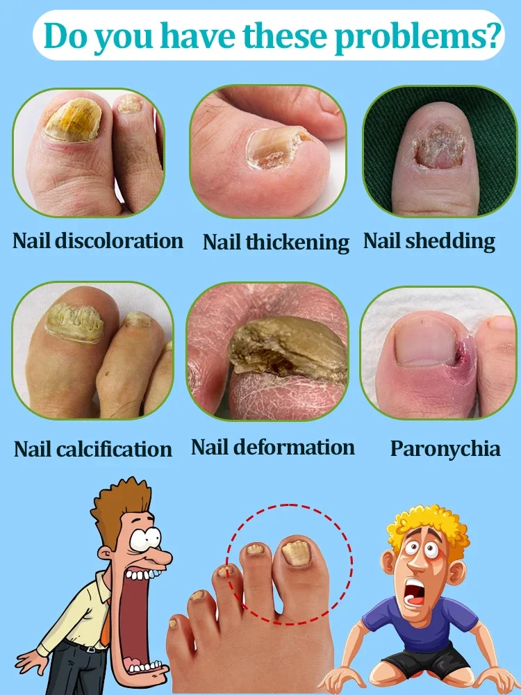 Foot nail problems disappear