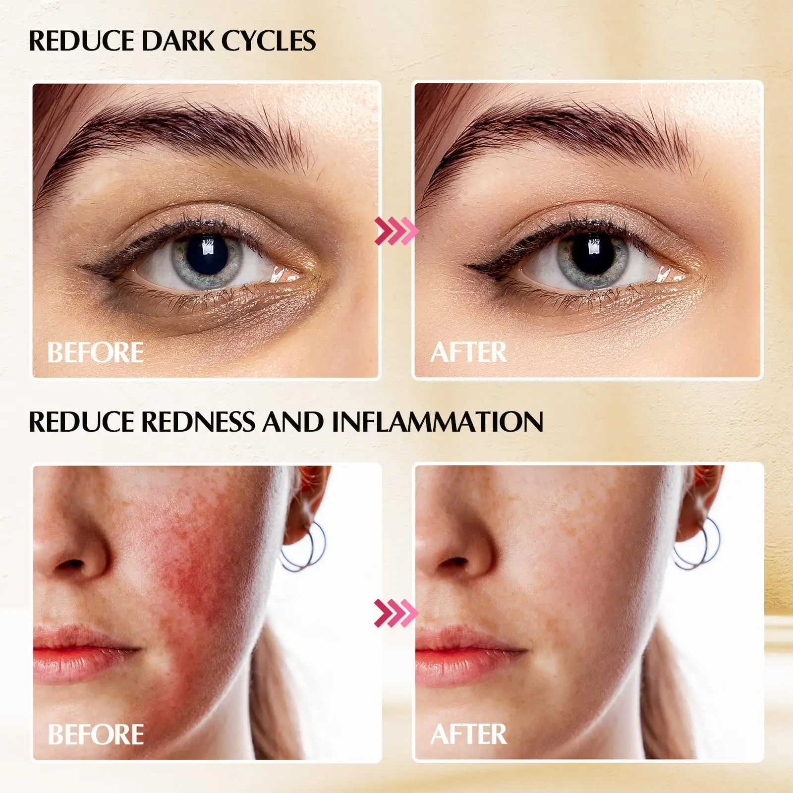 Varas de globos de gelo para cuidados com a pele facial, para mulheres, olhos faciais, ferramentas de beleza facial, suprimentos para esteticista, globos de spa de resfriamento